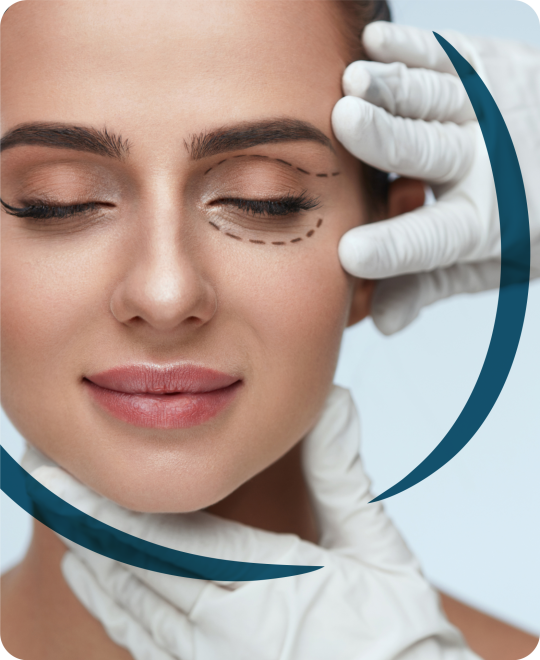 blefaroplastia