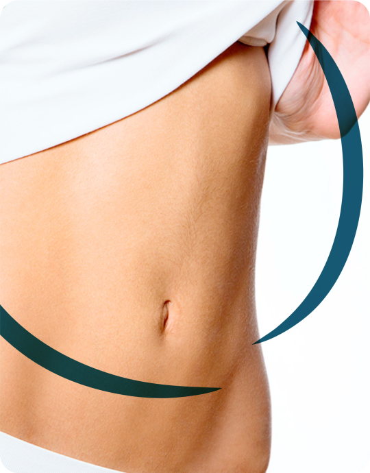 mini-abdominoplastia